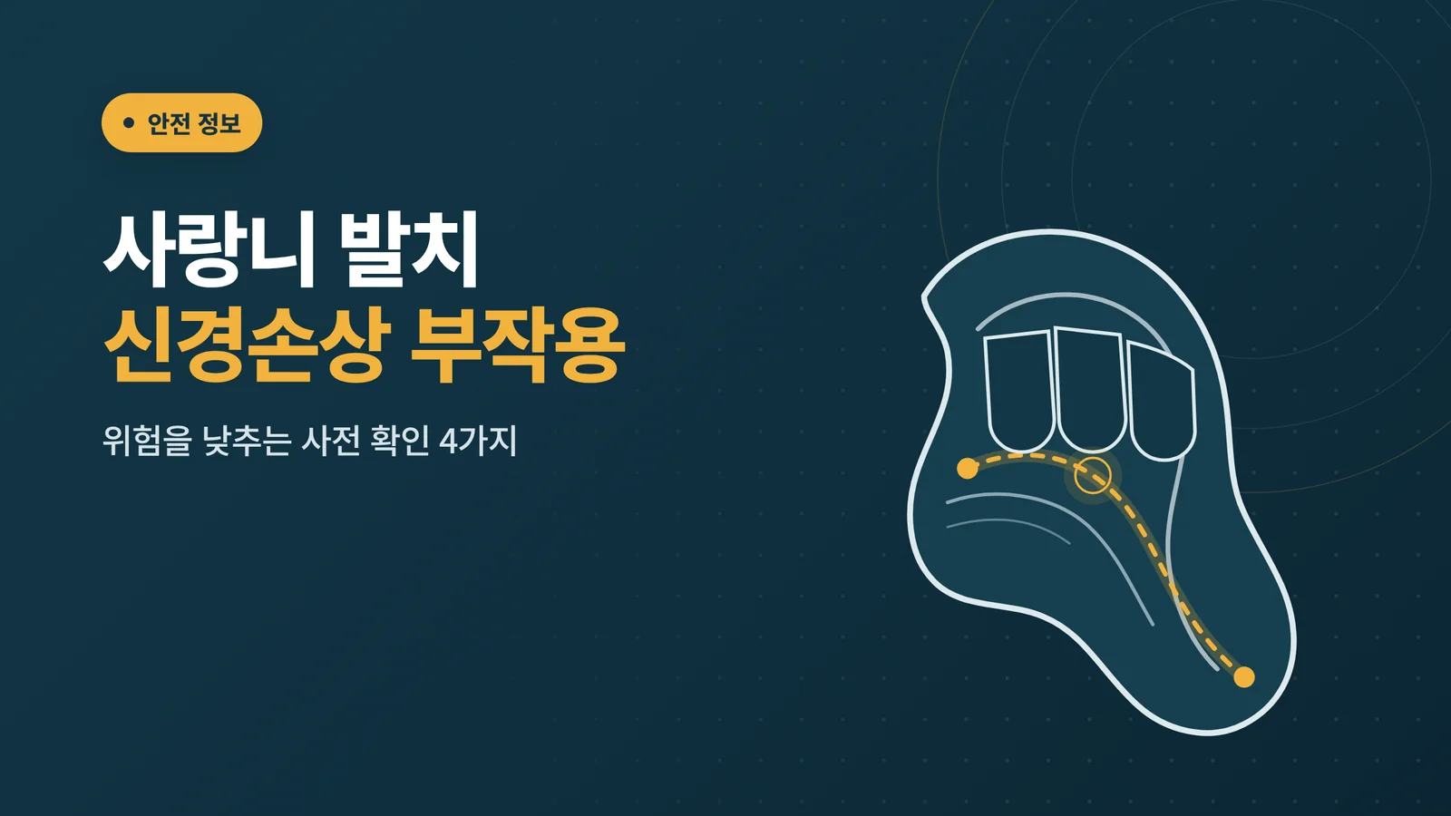 사랑니 발치 신경손상 부작용